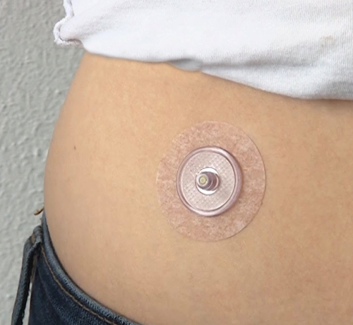 OR_base-on-body.png